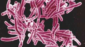TB bacteria